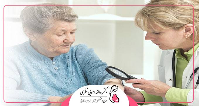 چطور از ابتلا به زگیل تناسلی پیشگیری کنیم؟